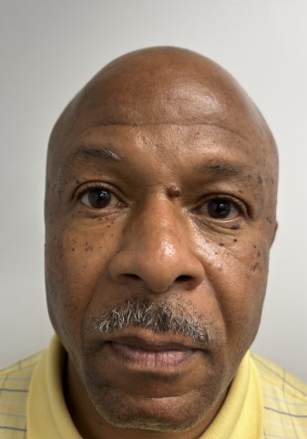 Official registry photo of ADONIS LEE HEWLETT